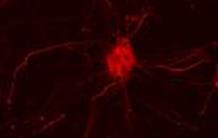 Alzheimer : une protéine prion mise en cause ?