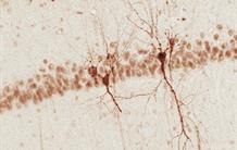 Neurofibrillary tangles: a protective role in Alzheimer's disease?