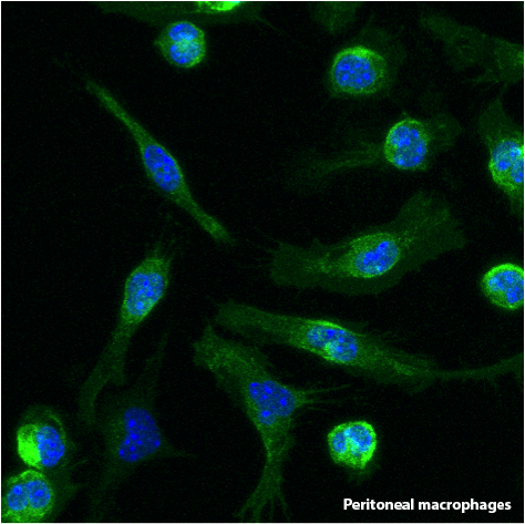 image Macrophage TRIM33.png