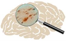 Stealthy agents in Alzheimer's disease