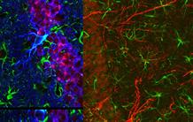 Maladies neurodégénératives : après les neurones, Tau s’attaque aux astrocytes