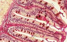 Covid-19 : le microbiome intestinal durablement affecté
