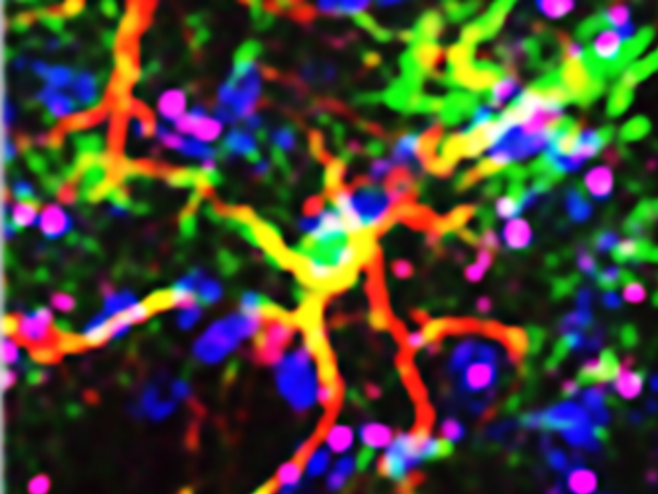 Maladie de Huntington : le rôle bénéfique des astrocytes réactifs