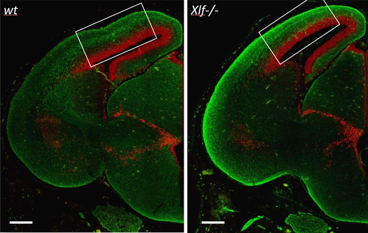 XLF/Cernunnos, neurogenèse prématurée et développement du cerveau