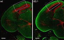 XLF/Cernunnos, neurogenèse prématurée et développement du cerveau