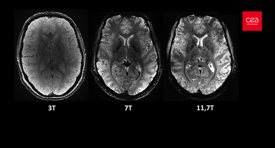 Le cerveau dévoilé comme jamais grâce à l’IRM le plus puissant au monde